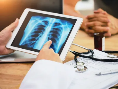 Patients who are at high risk of lung cancer can get screened with low-dose computed tomography (CT) scans.